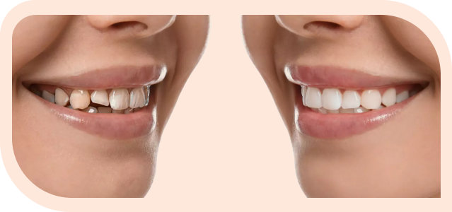 dental