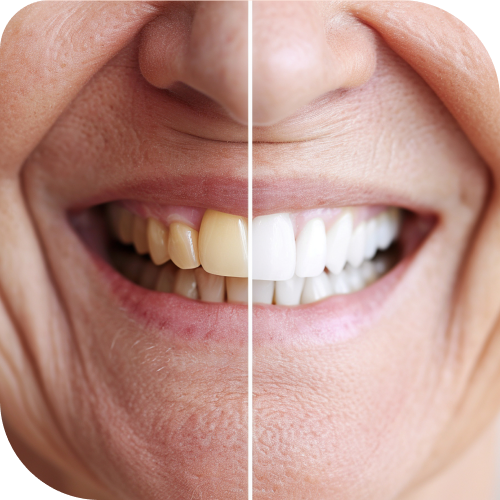 teethwhie