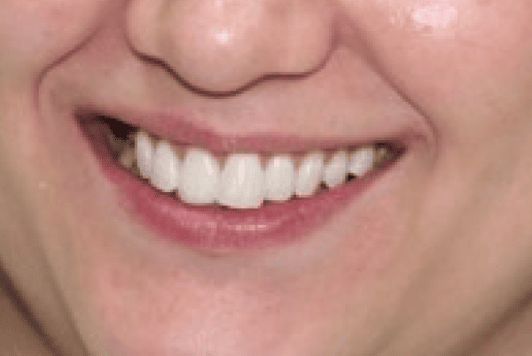 Frame 1000001271
